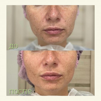 Ольга Федина, Moscow Фото - 5