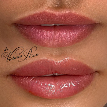 Виктория Рон, Moscow Фото - 5