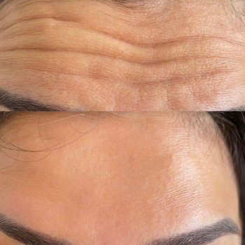 Альбина Давыдова, Moscow Фото - 6