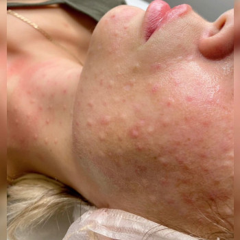 Белла Шадиева, Moscow Фото - 6