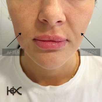 Халида Хафарова, Moscow Фото - 6