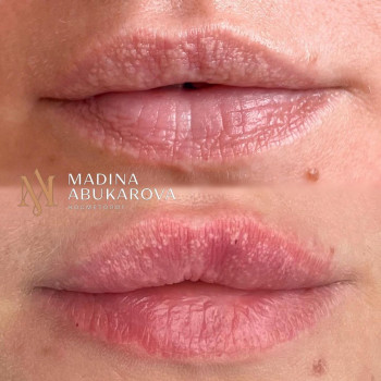 Мадина Абукарова, Moscow Фото - 6