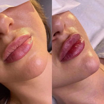 Ирина Ким, Moscow Фото - 5