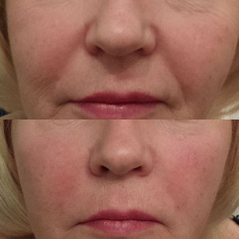 Светлана Зимурова, Moscow Фото - 5