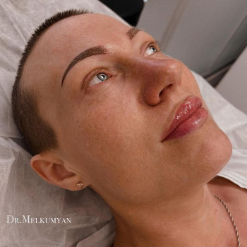 Анна Мелкумян, Moscow Фото - 5