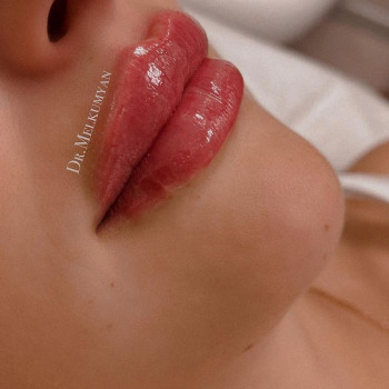 Анна Мелкумян, Moscow Фото - 6