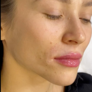 Румина , Moscow Фото - 5