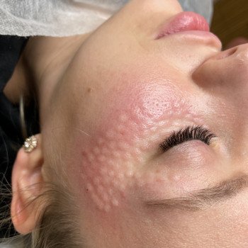 Анна Приходько, Варшава Фото - 23