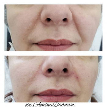 Амина Бабаева, Москва Фото - 5