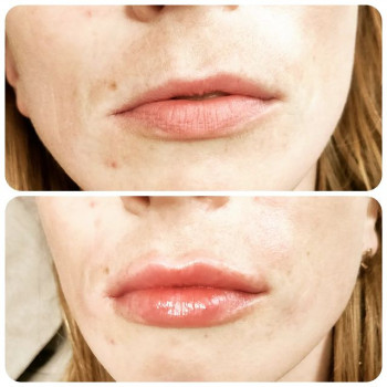 Анна Блохина, Moscow Фото - 5