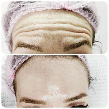 Анна Блохина, Moscow Фото - 6