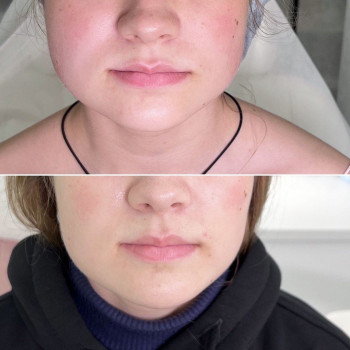 Христина Козыхина, Moscow Фото - 6