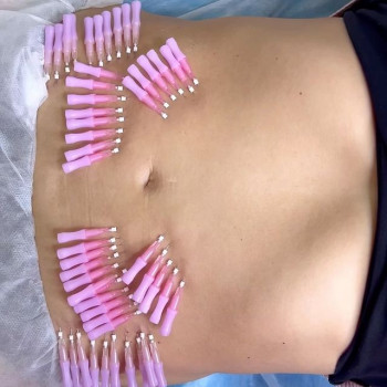 Владимир , Moscow Фото - 5