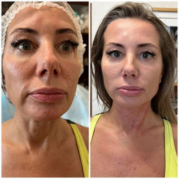 Анэт Рон, Moscow Фото - 5