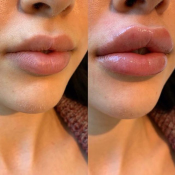 Солта , Moscow Фото - 5