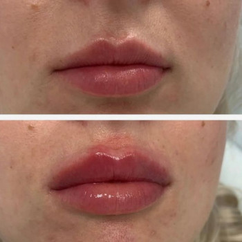 Солта , Moscow Фото - 6