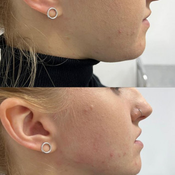 Солта , Moscow Фото - 7