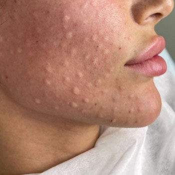 Зумруд Исаева, Moscow Фото - 5