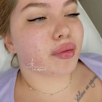 Айнур Зулфигарова, Moscow Фото - 6