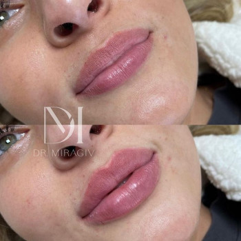 Алена Свиридова, Moscow Фото - 5