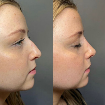 Наталия Миронова, Moscow Фото - 5