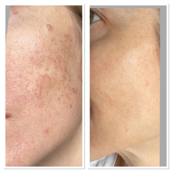 Татьяна Емельянова, Moscow Фото - 5