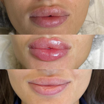 Аврора Никитина, Moscow Фото - 5