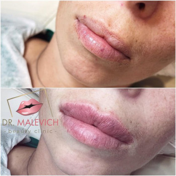 Валерия Малевич, Krasnogorsk Фото - 5