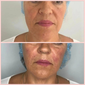 Анаит Тер-Акопова, Moscow Фото - 5