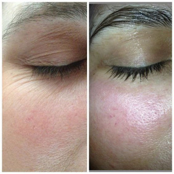 Ширен Козуева, Москва Фото - 5