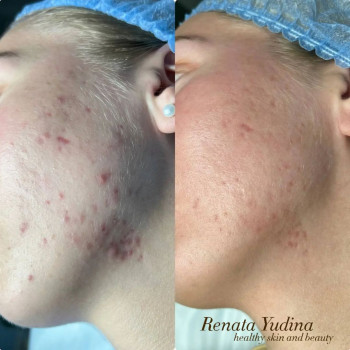 Рената Юдина, Moscow Фото - 5