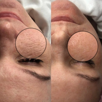 Алла Рябинкина, Москва Фото - 5