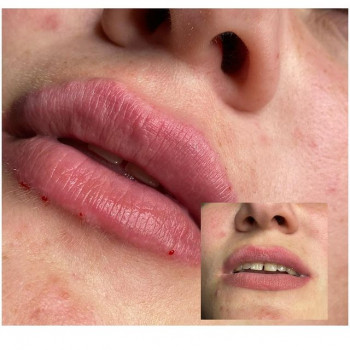 Людмила Пролыгина, Lyubertsy Фото - 5