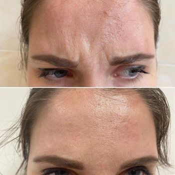 Анна Останина, Moscow Фото - 6