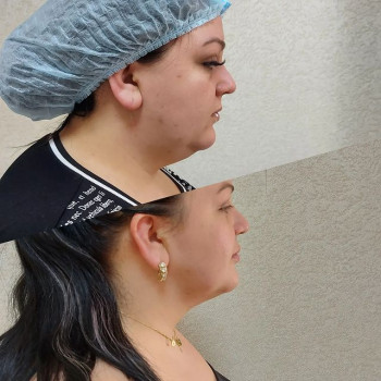 Людмила Калентьева, Moscow Фото - 6