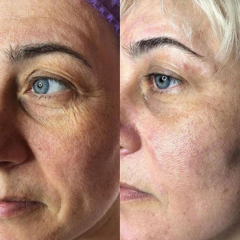 Оксана Хуторная, Moscow Фото - 5