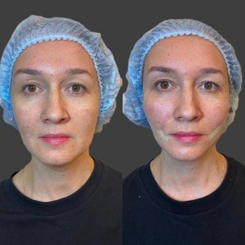 Алсу Шаимярдянова, Moscow Фото - 5