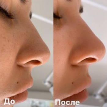 Наталья Белоглазова, Moscow Фото - 5