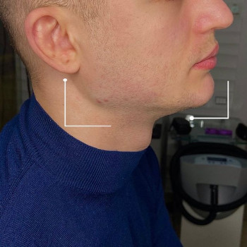 Залина Габилина, Moscow Фото - 5