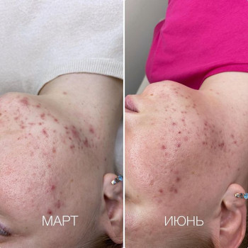 Анастасия Антипова, Odintsovo Фото - 5