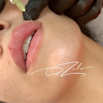 Зульмира , Москва Фото - 5