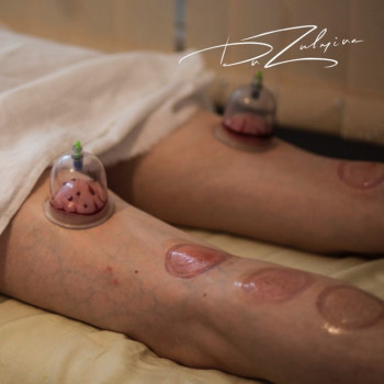 Зульмира , Москва Фото - 6