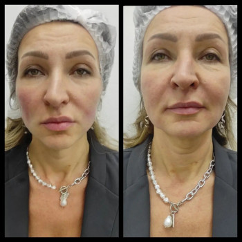 Алина , Moscow Фото - 5