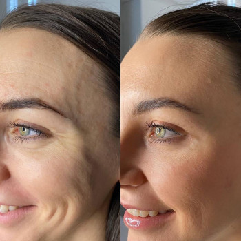 Ольга Заклюка, Moscow Фото - 5