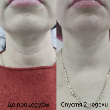 Ирина Логвиненко, Moscow Фото - 5