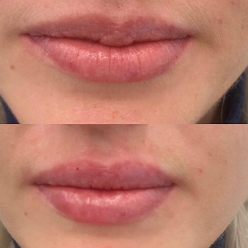 Екатерина Белякина, Moscow Фото - 5