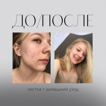 Лилия Торощина, Moscow Фото - 5