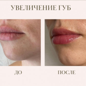 Анастасия Лёкина, Moscow Фото - 5