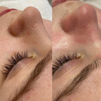 Аделина , Moscow Фото - 6