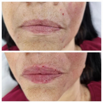 Елена Чегаева, Moscow Фото - 6